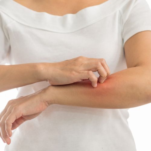 Nuovo studio clinico GLISTEN